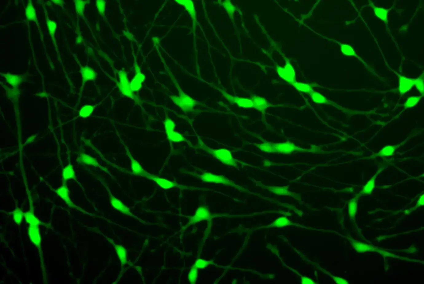 bionops glutathion r GFP Glutamatergic Neurons AOD-9604 peptide supplier
